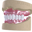 5.png Digital Full Dentures with Combined Glue-in Teeth Arch