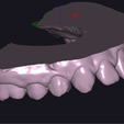 Pac-A-MAX-SUP-Zocalado.png BOTH MAXILLARS - SUPERIOR and INFERIOR "ready for 3D printer" - AREA3D- Patient A. COMPLETE DENTURE