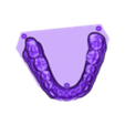 789513050_20231212_1352_Tech_01__bruxi_Antag.stl BRUXISM TRAY - 3 stl files (try+model+antagonist)