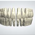foto1.jpg 3Shape OPEN Library AP_Exo_FSP