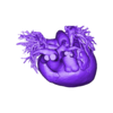 STL.stl 3D Model of Human Heart with Double Superior Vena Cava (DSVC) - generated from real patient