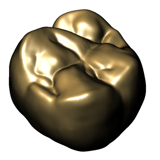 Maxillary Molar 1 - 3D model önizlemesi