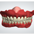 22.png Digital Full Dentures with Combined Glue-in Teeth Arch