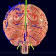 screenshot156.jpg Central nervous system cortex limbic basal ganglia stem cerebel 3D model