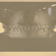 Screenshot_32.png Digital Orthodontic Study Models with Virtual Bases