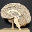 1687378174358.jpg Brain for human anatomy study, Split hemispheres + support.
