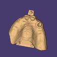 Clipboard-2024-12-21-00-27-17.jpg DIGITAL FLEXIBLE UPPER PARTIAL DENTURE  (3D models !!!) - 7 stl files for download)