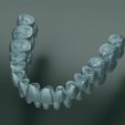 dental-anatomy-and-root-structures-3d-model-58235692df.jpg Dental Anatomy and Root Structures