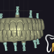 Screenshot-2024-11-17-012647.png All Collection For exocad