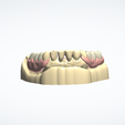 Snímka-obrazovky-2024-04-06-124219.png LOWER PARTIAL REMOVABLE DENTURE + 3D MODELS !