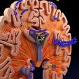 ps41.jpg Alzheimer Disease Brain coronal slice