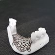 706221-2.jpg Individual mesh membrane for bone reconstruction of the jaw (examples of real operations)