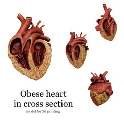 2BF3B36A-689D-4A6D-8993-217FF900D3BC.jpeg Anatomical human obese heart in cross section