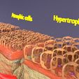 1397.jpg adaptation epithelial cell changes normal to cancer Low-poly 3D model