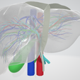 fibrotic-LIVER,-abdominal,-abdomen,-spleen,-pancreas,-pancreatic,-biliary,-hepatic,-artery,-vein,-po.png 6 PIÈCES Modèle 3D réaliste du foie atteint de cirrhose (fibrose) - avec système biliaire, veines portales, veines et artères hépatiques, ligaments du foie