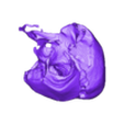 STL00005.stl 3D Model of Human Heart with Double Aortic Arch (DAA) - generated from real patient