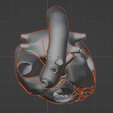 13.png 3D Model of Heart with Tetralogy of Fallot (ToF)