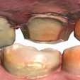 IO-Data-Pack-Pic-II.png Dental Design Practice - Intraoral  Scans