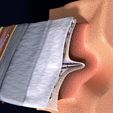 17.jpg Brain with meninges scalp detailed labelled 3D