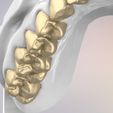 26.jpg 3D Dental Jaws Replica with Detachable Teeth
