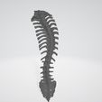 2.jpg Scoliosis spine 1