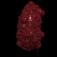 4.jpg 3D Model of Polycystic Kidney
