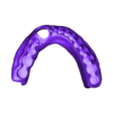 789513050_20231215_1420_Tech_01_HaD_parcialky_2_Print.stl PARTIAL REMOVABLE DENTURES ( upper + lower) - flexible