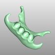 Clipboard-2024-02-25-15-22-36.jpg FLEXIBLE FLIPPER lower jaw + 3D MODELS !!!