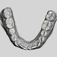 Imagen2.jpg Ready-to-print dental practice models