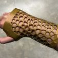 IMG_8134.jpg Wrist Splint Demo