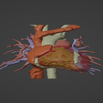 1.png 3D Model of Human Heart with Double Aortic Arch (DAA) - generated from real patient