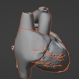 11.png 3D Model of Heart with Tetralogy of Fallot (ToF)