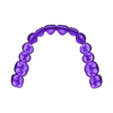 789513050_20230710_1202_Tech_01_3.stl TOTAL REMOVABLE DENTURES - 4 stl files (upper jaw, lower jaw, artificial teeth for upper and lower jaw)