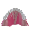 19.png Digital Full Dentures with Combined Glue-in Teeth Arch