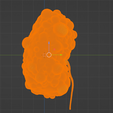 33.png 3D Model of Polycystic Kidney