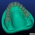Screenshot_3.png Phantom dental model with single crowns and bridges