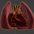 3.png 3D Model of Transposition of the Great Arteries Open Duct