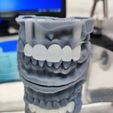 1.jpg dental model with removable and bridge/ Dental model with removable and bridge/
