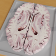 corte-transversal-render.png BRAIN FOR THE STUDY OF HUMAN ANATOMY, CORONAL AND TRANSVERSAL SECTIONS