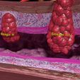 sigps7.jpg 3D Colon cancer staging detail labelled