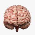 Front.jpg Human Brain