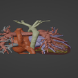 3.png 3D Model of Human Heart with Mirror Dextrocentric - generated from real patient