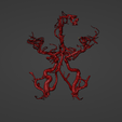 w18.png 3D Model of Brain Arteriovenous Malformation