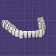 Dentes-Mandibula-Ashortia-Exocad.jpg Teeth mandibule - Ashortia - Exocad