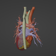 2.png 3D Model of Human Heart with Co-Arctation (CA) - generated from real patient