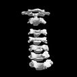 vertebra-7.jpg Archivo STL El modelo de la columna cervical C1-C7 con una parte del cráneo・Modelo para descargar y imprimir en 3D