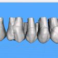 Dentes-Maxila-Robtoly-Unique-Exocad-03.jpg Teeth Upper Jaw - Exocad - Robtoly-Unique