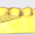 Captura-de-pantalla-615.png Model of dental endodontics