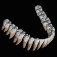 IMG_1310.jpg Mandibular teeth