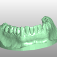 Imagen2.png Complete dental model